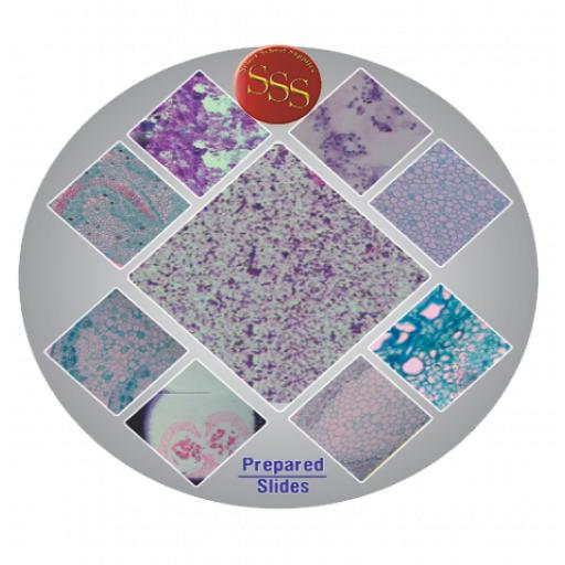 MICROSCOPE SLIDE - Human blood smear unstained slide (shows platelet count)