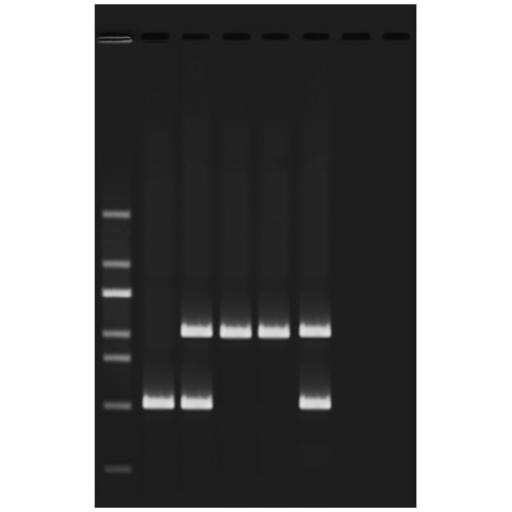 Alu Human DNA Typing Using PCR