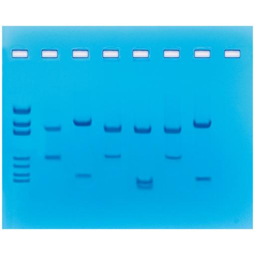 DNA Fingerprinting Using Restriction Enzymes