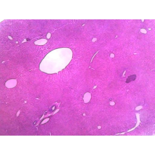 MICROSCOPE SLIDE - Liver injected section