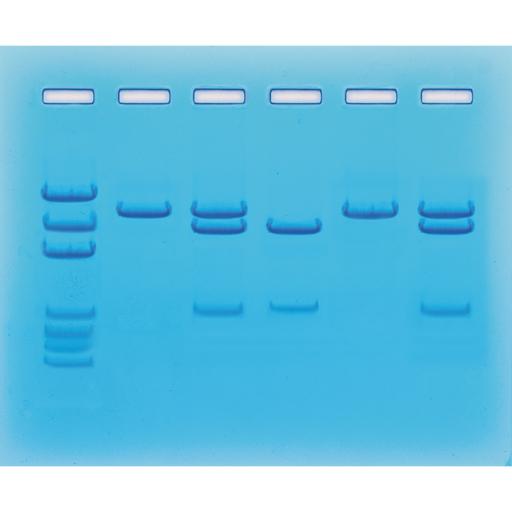 Nucleic Acid Testing for COVID-19