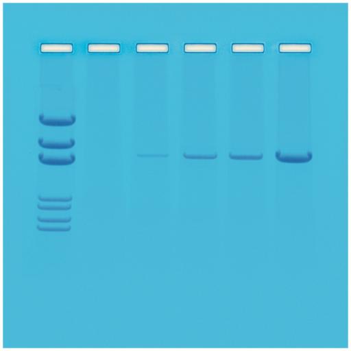 Principles of PCR