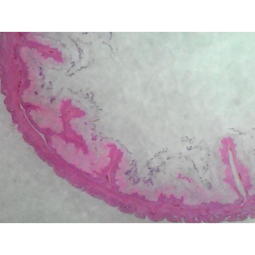 MICROSCOPE SLIDE - Stomach to show mucus cells parietal