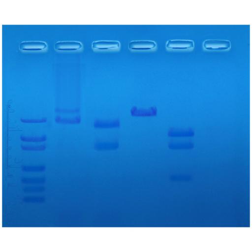 Restriction Enzyme Mapping