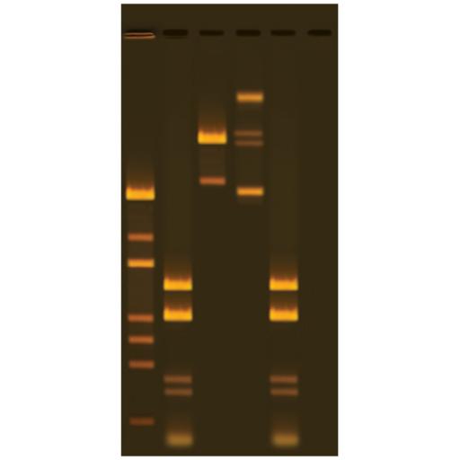 Analysis of DNA Methylation Using Restriction Enzymes