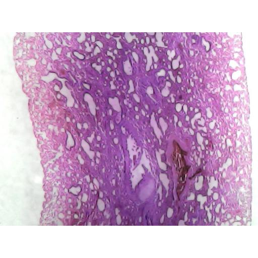 MICROSCOPE SLIDE - Lung T.S. thin section plastic embedded