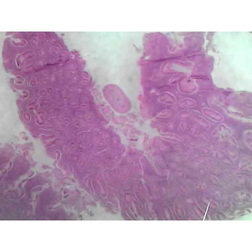 MICROSCOPE SLIDE - Small intestine L.S.