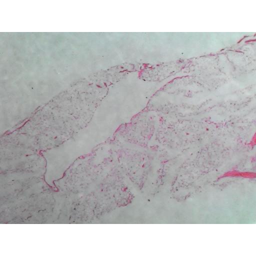 MICROSCOPE SLIDE - Adipose tissue section H.2-2
