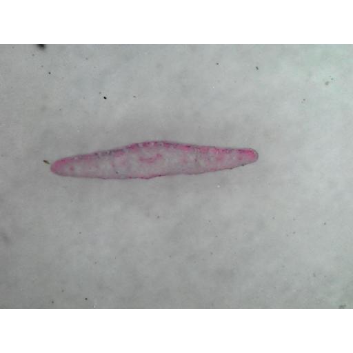 MICROSCOPE SLIDE - Erica T.S. xerophytic leaf